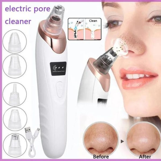 Blackhead remover